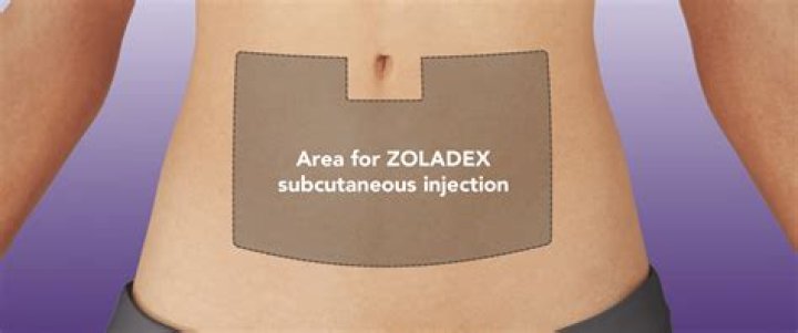 What does Zoladex do to ovaries?