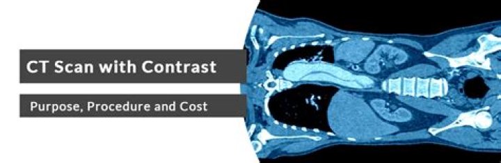 What is a contrast enhanced CT scan?
