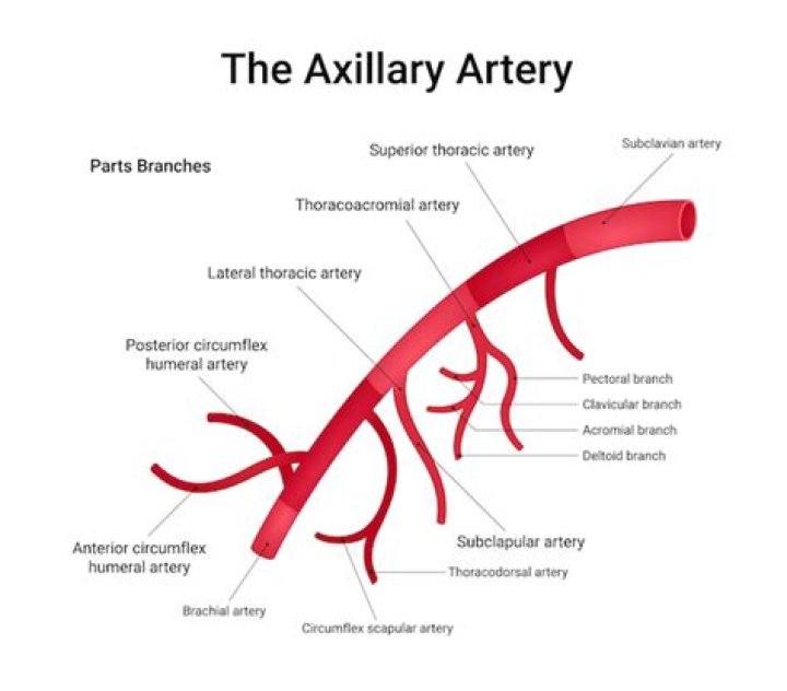 What is a right axillary dissection?