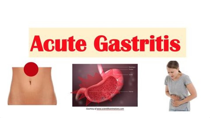 What is an acute gastritis?
