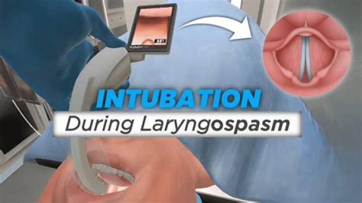 What is an Orogastric intubation?