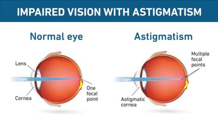 What is astigmatism aberration?