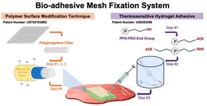 What is bioadhesive gel?