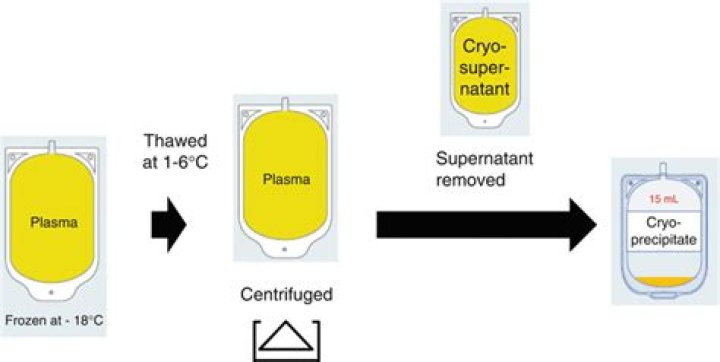 What is Cryo transfusion?