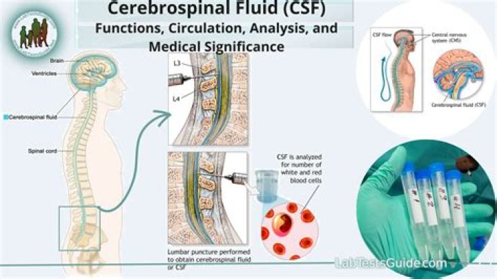 What is CSF pulsation