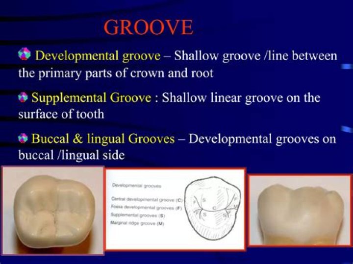 What is dental groove?