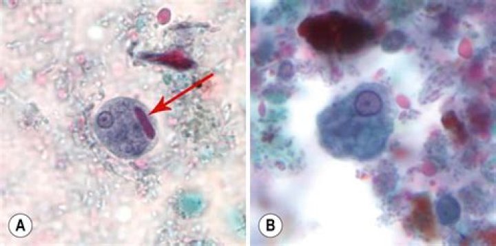 What is Entamoeba Hartmanni Trophozoites?