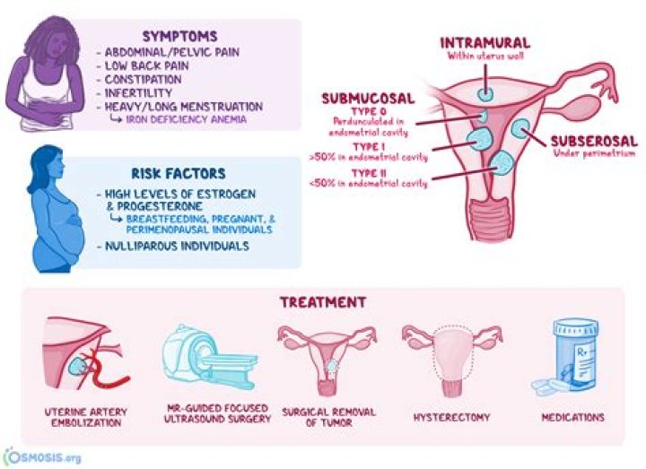 What is leiomyoma of uterus?