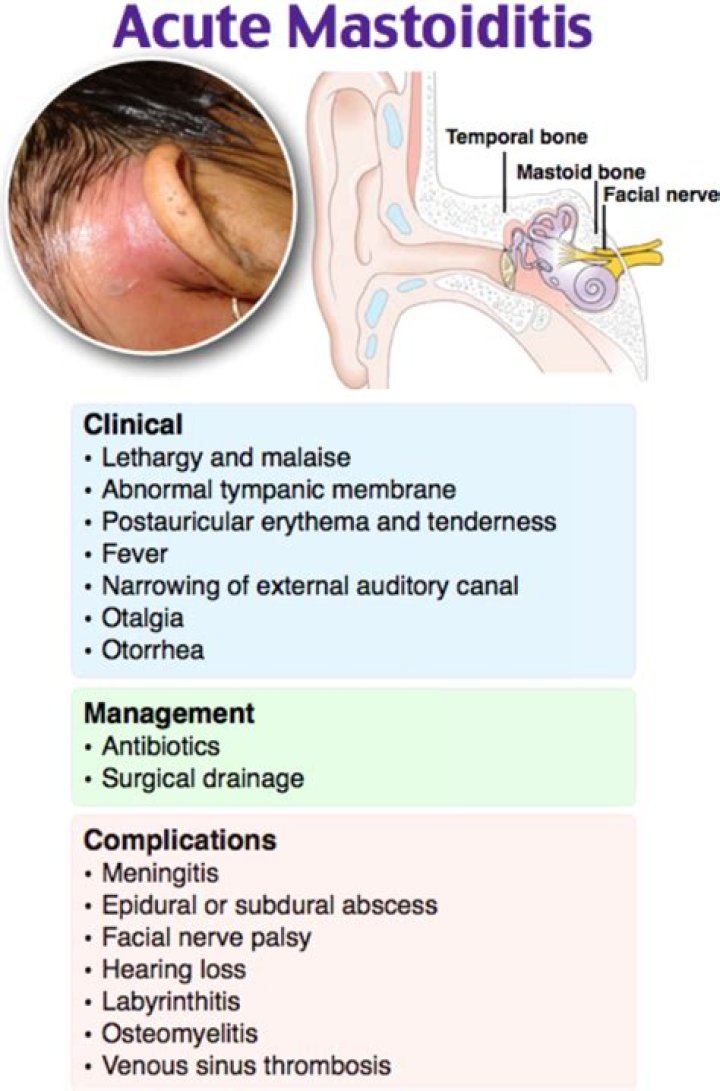 What is mastoid sinus disease?
