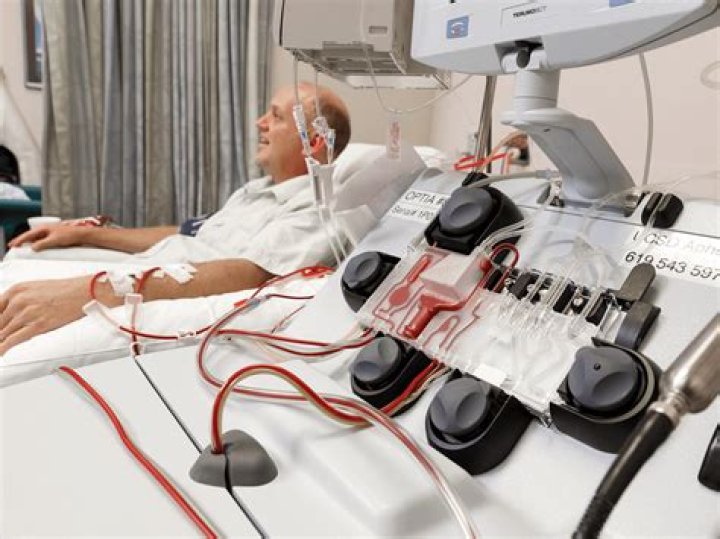 What is photopheresis procedure?