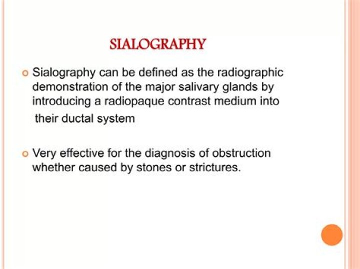 What is Sialography Slideshare?