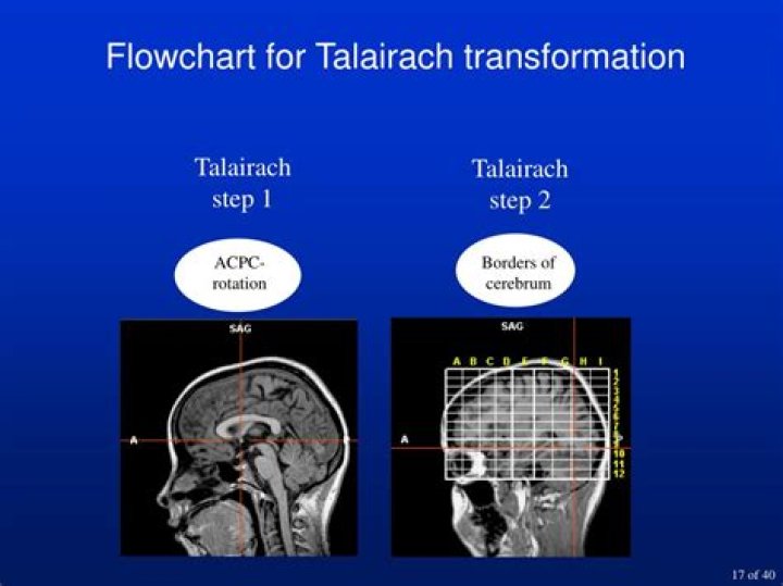 What is Talairach transformation?