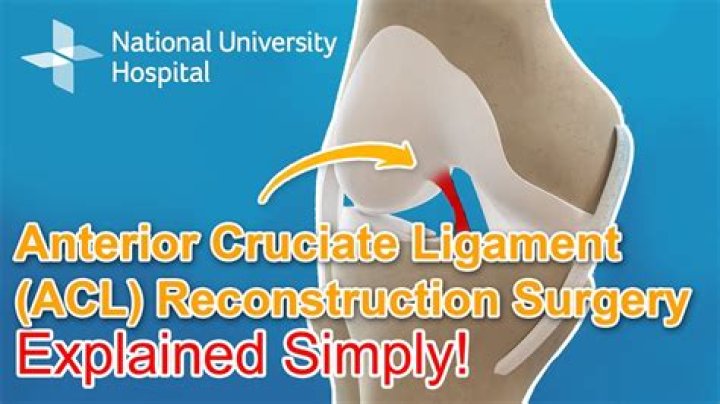 What is the CPT code for ACL reconstruction with allograft?