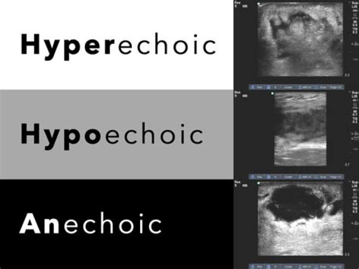 What is the difference between hypoechoic and hyperechoic?