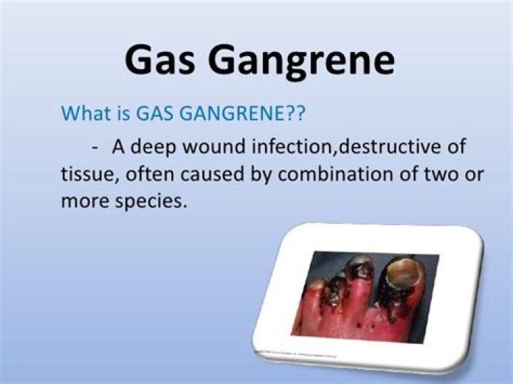 What is the gas in gas gangrene
