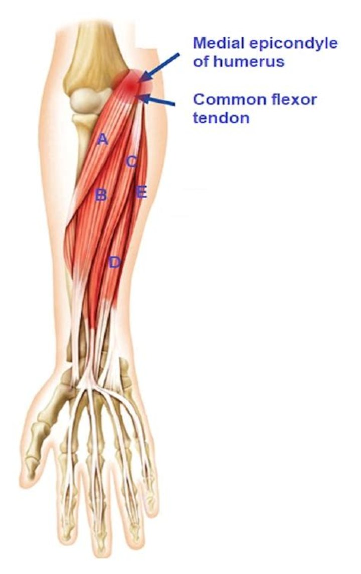 What is the medial epicondyle?