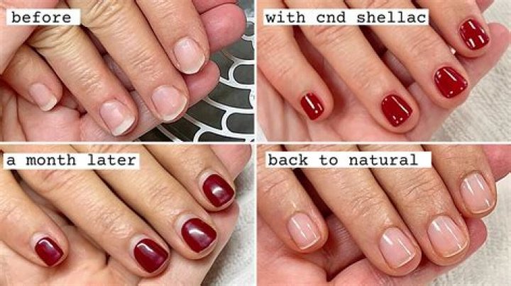 What manicure is least damaging to nails?