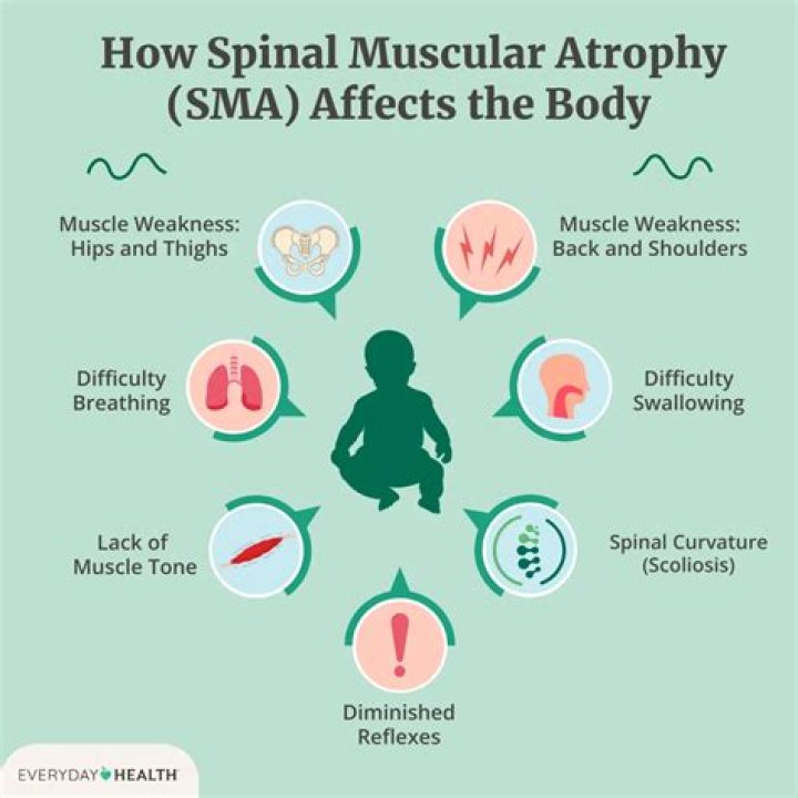 What muscles are affected by SMA?