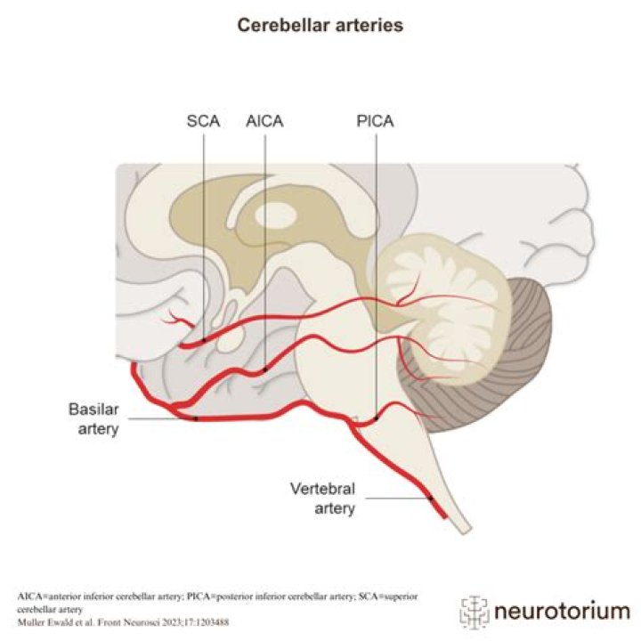 What regions of the brain could be affected by a CVA in the middle cerebral artery?