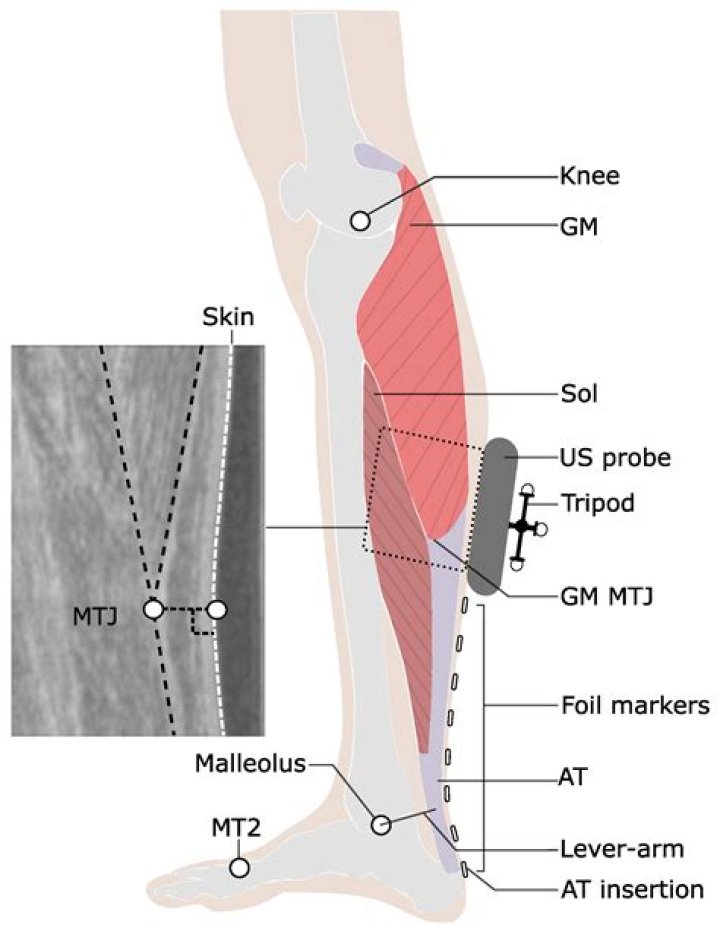 Where is the most common site for a tear in the Musculotendinous unit
