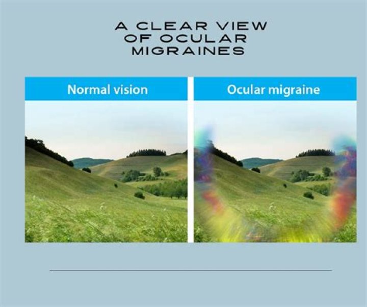 Why am I suddenly getting ocular migraines?