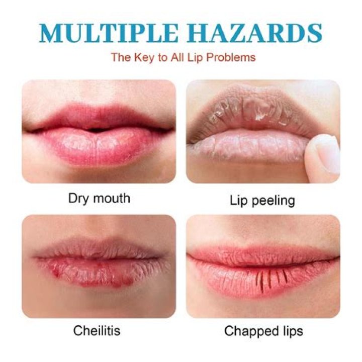 Why are my lips always pink?