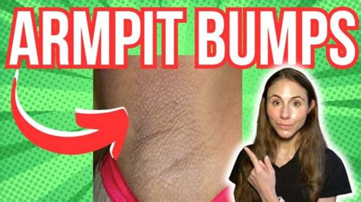Why do I get bumps on my legs after working out?
