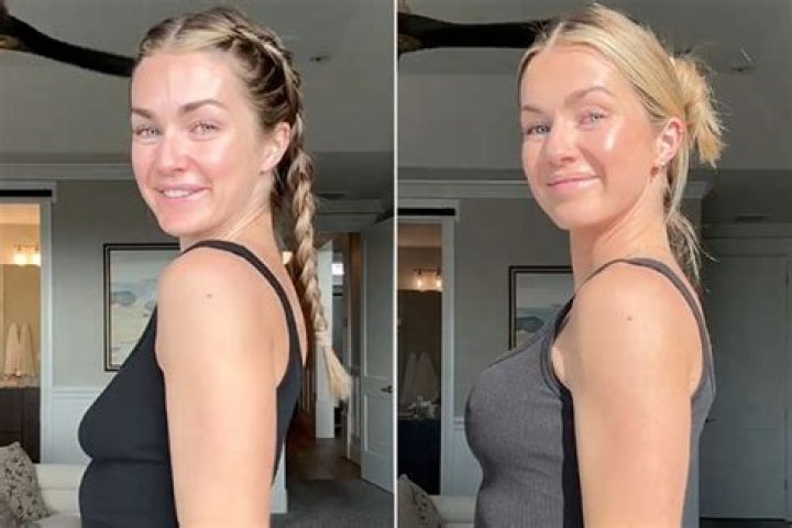 Why do my boobs look like cones after breast augmentation?