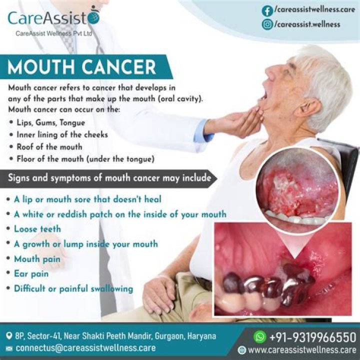 Why does mouth cancer occur?