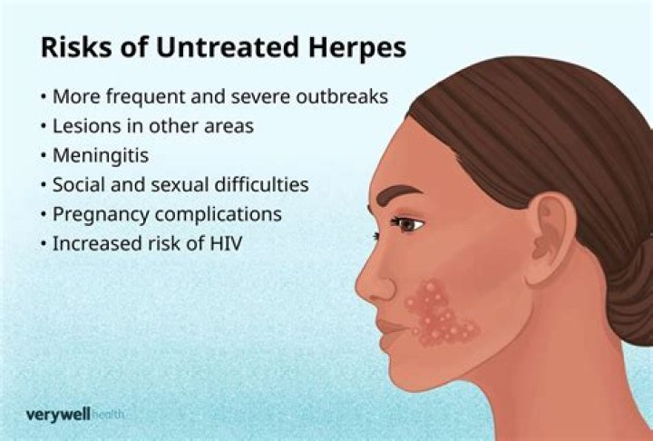 Why is herpes considered an STD