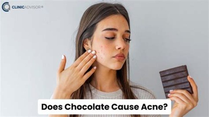 Will dark chocolate cause pimples?